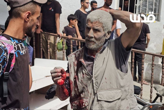 LIVEBLOG: Gaza Reels: Hundreds Dead, Wounded in Day of Israeli Atrocities amidst Ceasefire Reports – Day 634